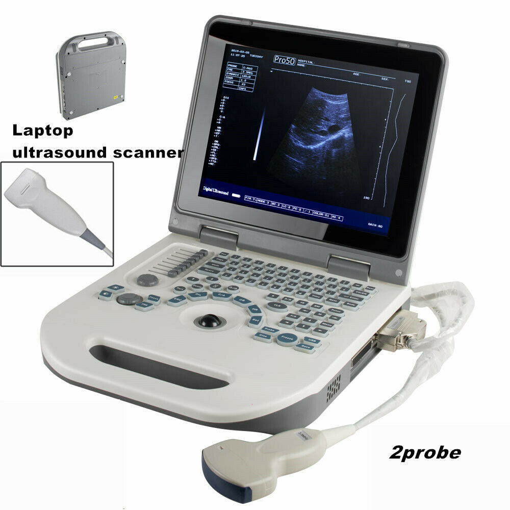 Portable Laptop Digital Ultrasound Scanner Machine with 3.5MHz Convex Probe+3D DIAGNOSTIC ULTRASOUND MACHINES FOR SALE