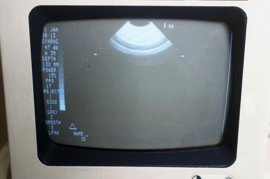 minitor device medical ultrasound