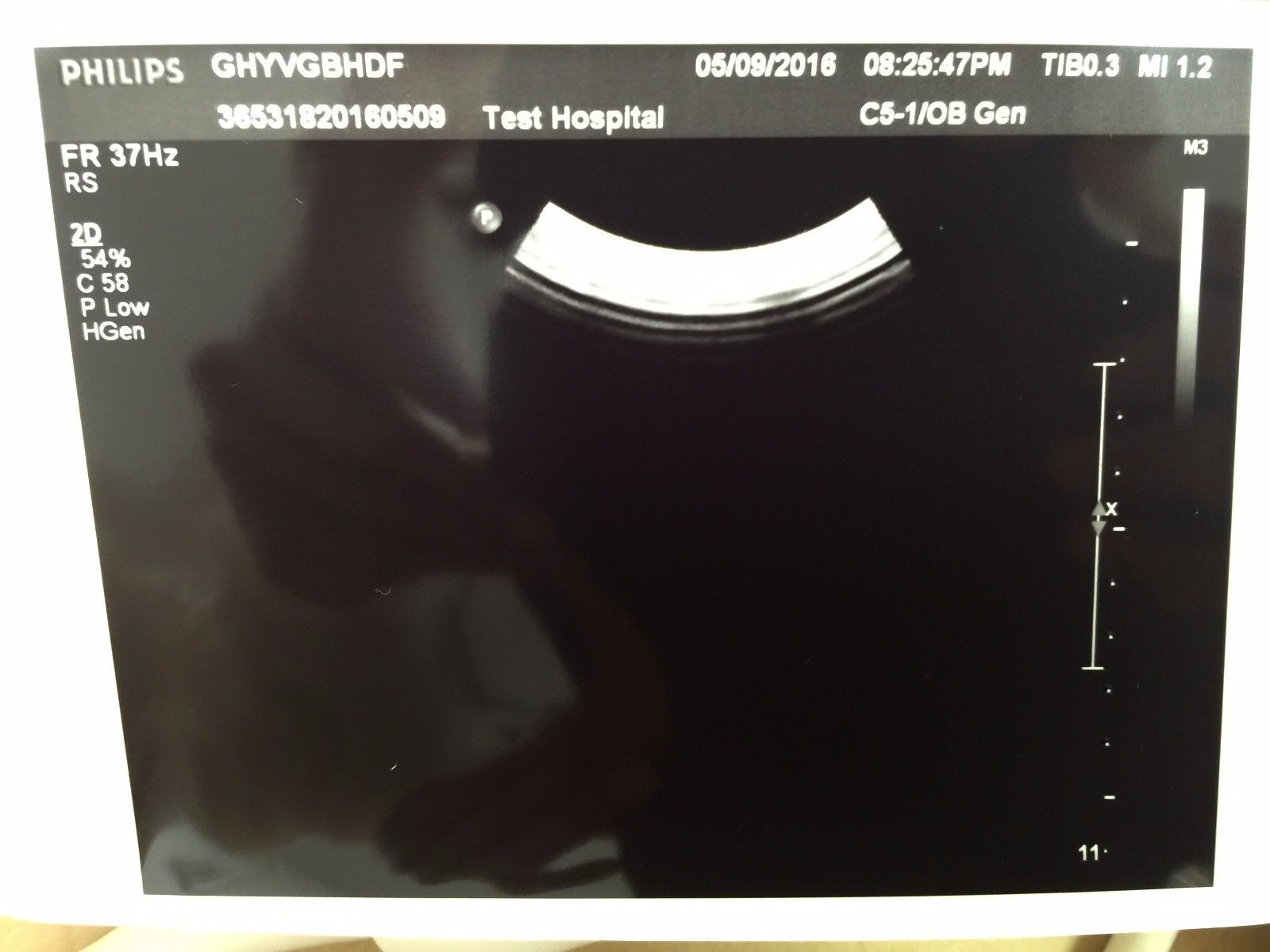Philips C5-1 Convex Ultrasound Transducer for Philips iU22 Systems DIAGNOSTIC ULTRASOUND MACHINES FOR SALE