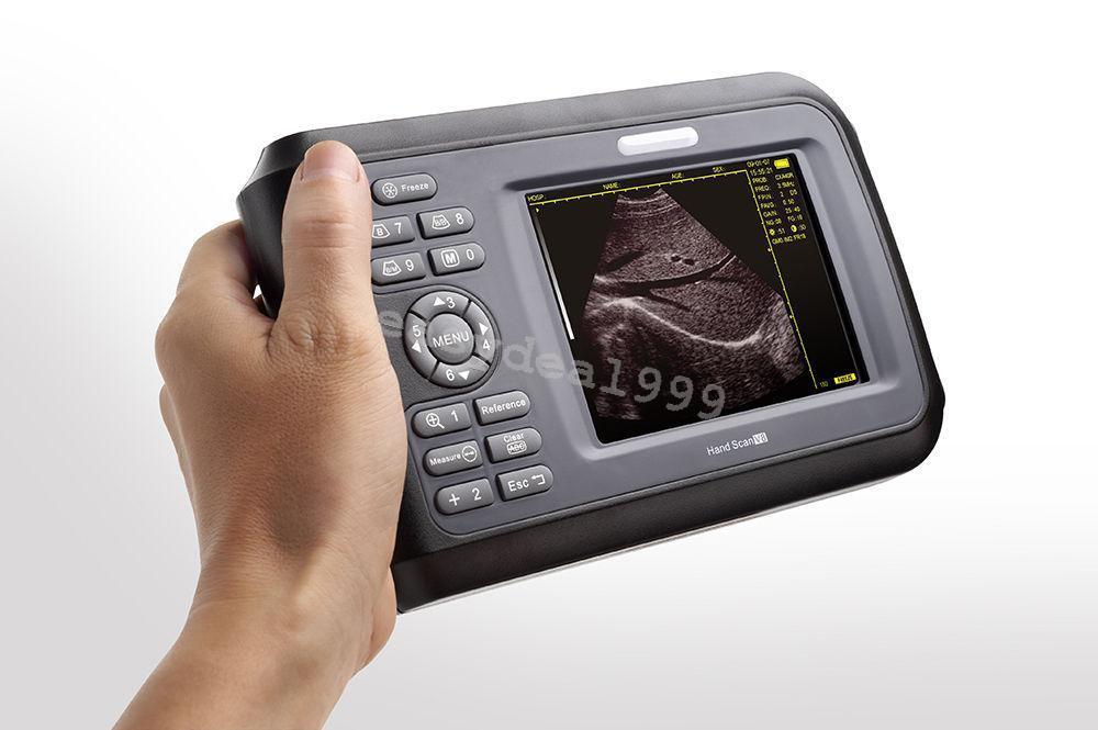 Portable Handheld Digital Ultrasound Scanner Transvaginal Probe Battery AC Case DIAGNOSTIC ULTRASOUND MACHINES FOR SALE