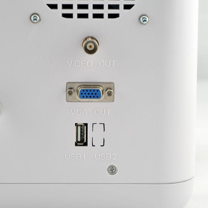 Medical Digital Ultrasound Scanner Machine + Convex + Linear Probes 3D Sale 190891868398 DIAGNOSTIC ULTRASOUND MACHINES FOR SALE