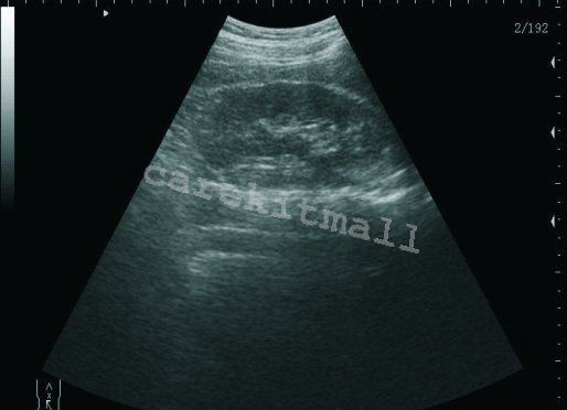 Portable Laptop Digital LCD Testor Ultrasound scanner with Transvaginal Probe CE 190891495471 DIAGNOSTIC ULTRASOUND MACHINES FOR SALE