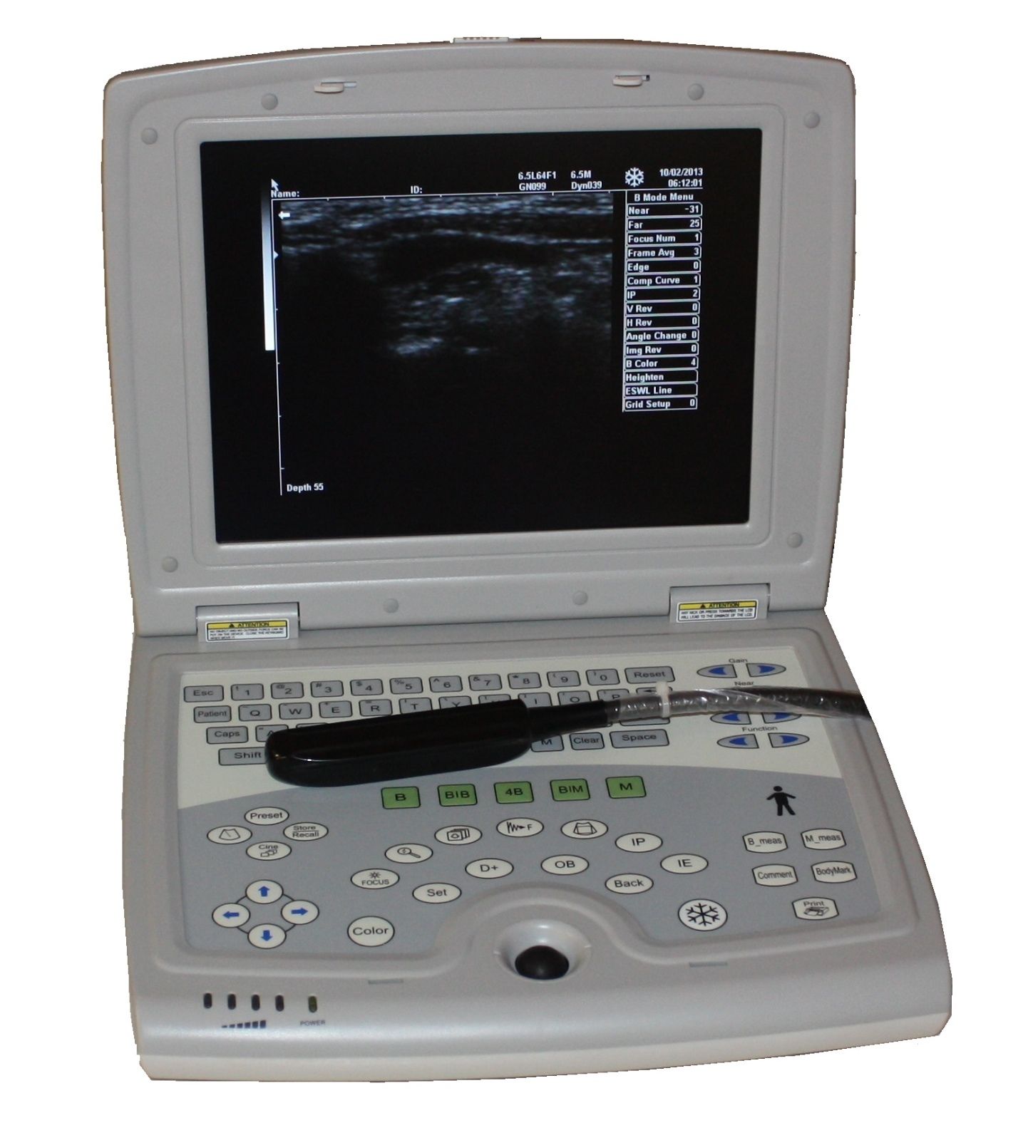 KX5000V Quality Veterinary Laptop Ultrasound Scanner LED & Rectal Probe-KeeboMed DIAGNOSTIC ULTRASOUND MACHINES FOR SALE