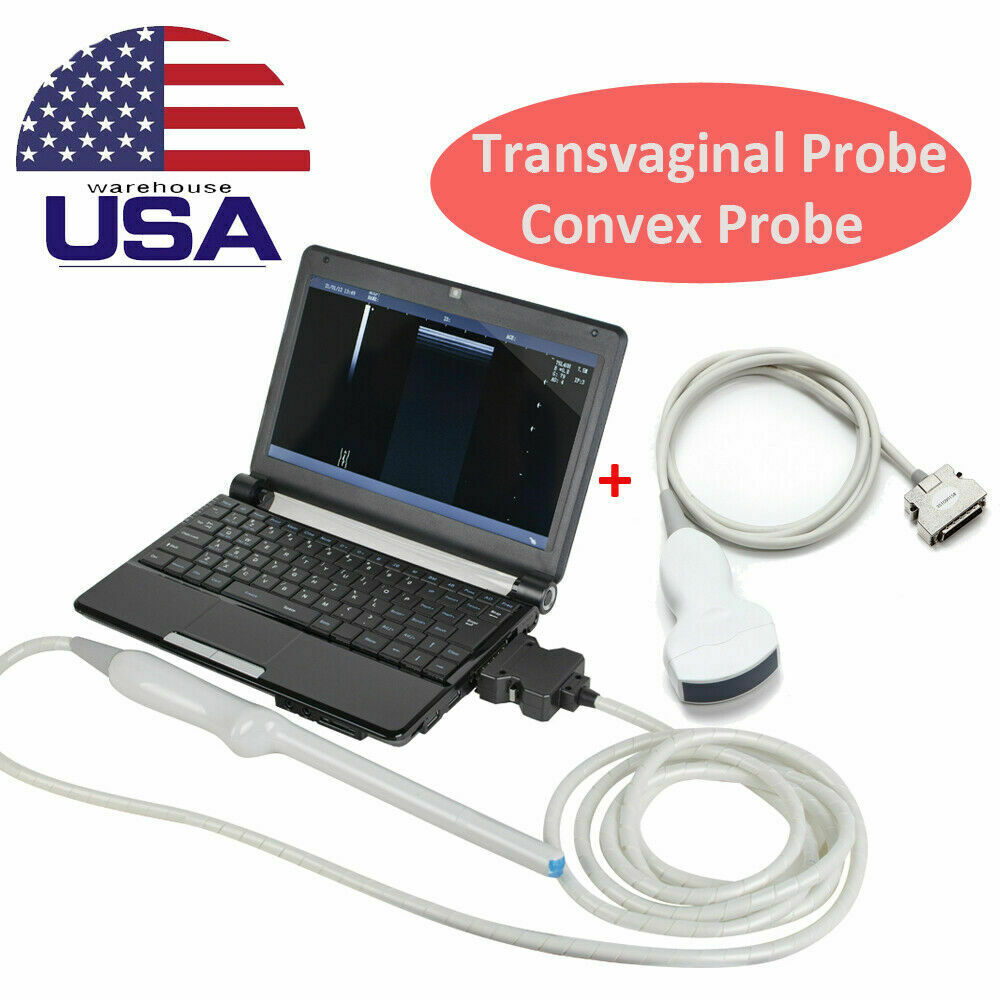 Digital Laptop Ultrasound Scanner Machine Transvaginal Probe Micro Convex Probe DIAGNOSTIC ULTRASOUND MACHINES FOR SALE