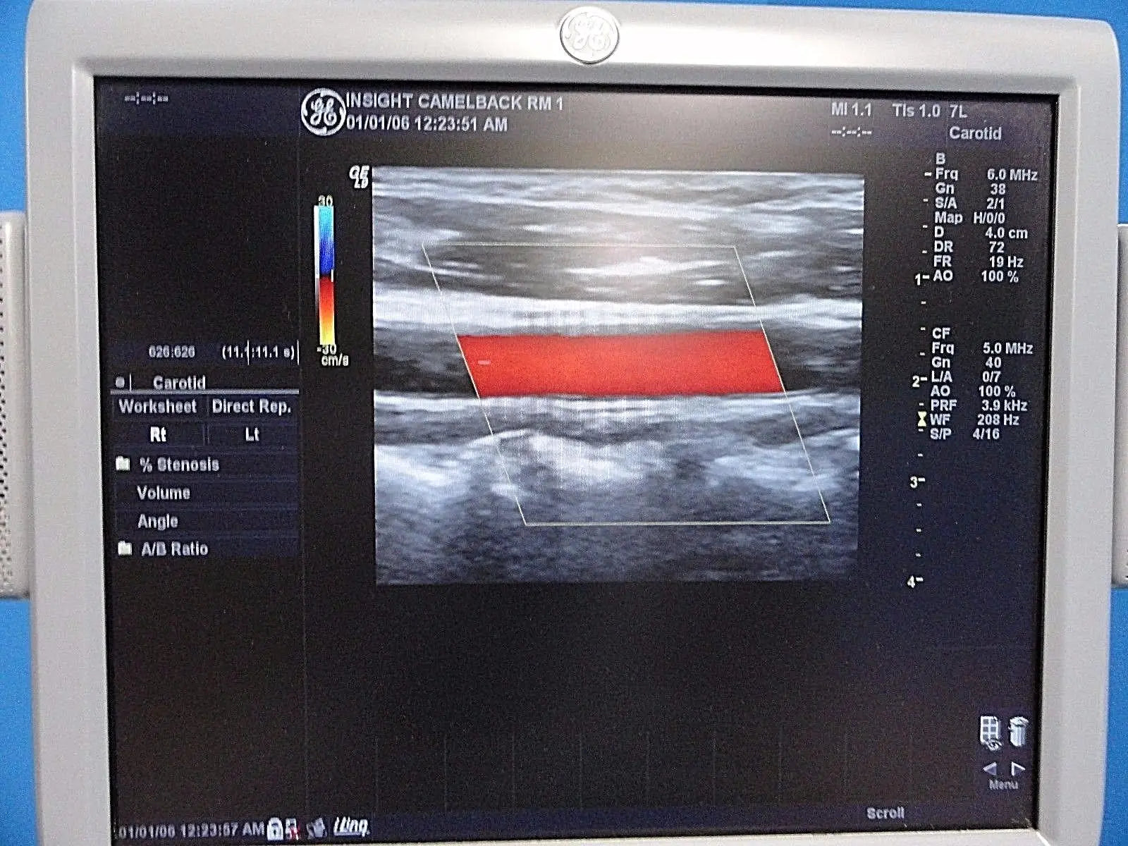GE 7L / 2302648 Linear Array Ultrasound Probe for Logiq & Vivid Series~13787 DIAGNOSTIC ULTRASOUND MACHINES FOR SALE