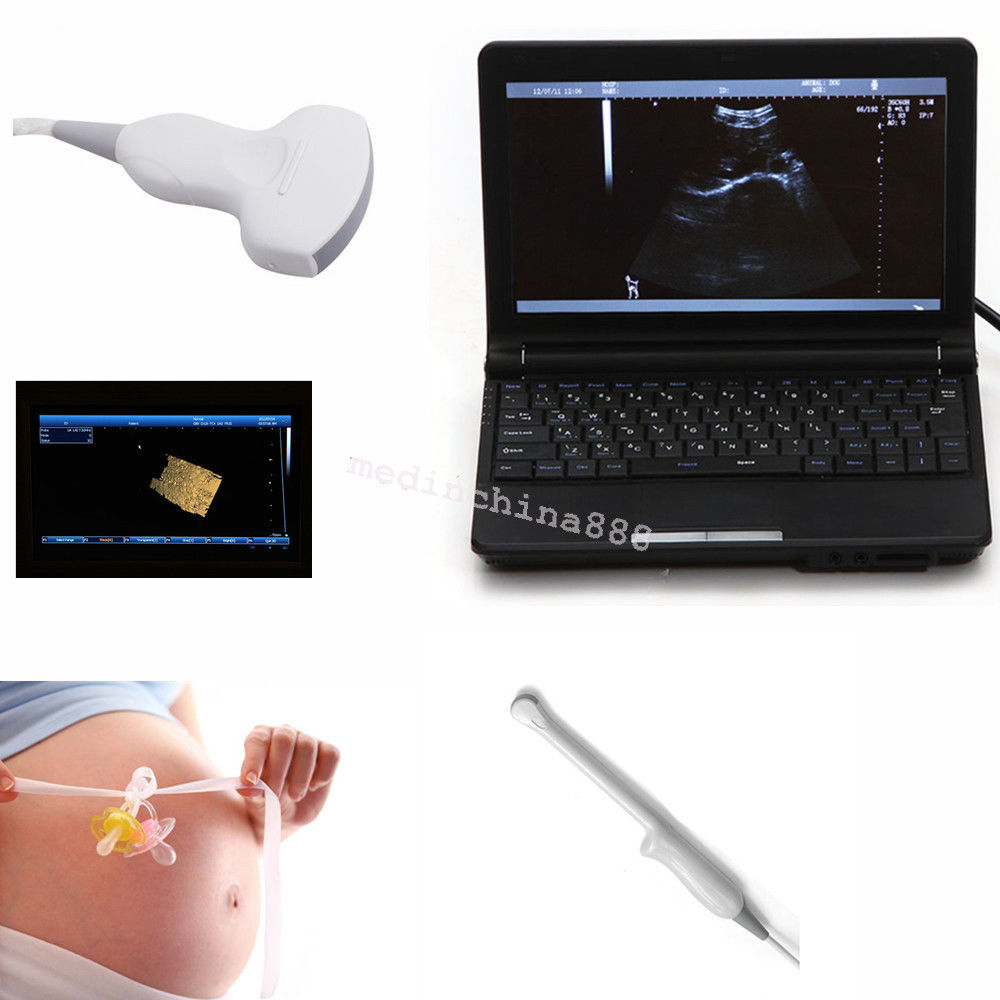 Portable LCD Digital 10.1-Inch Ultrasound Scanner + Convex+Transvaginal Probe CE DIAGNOSTIC ULTRASOUND MACHINES FOR SALE