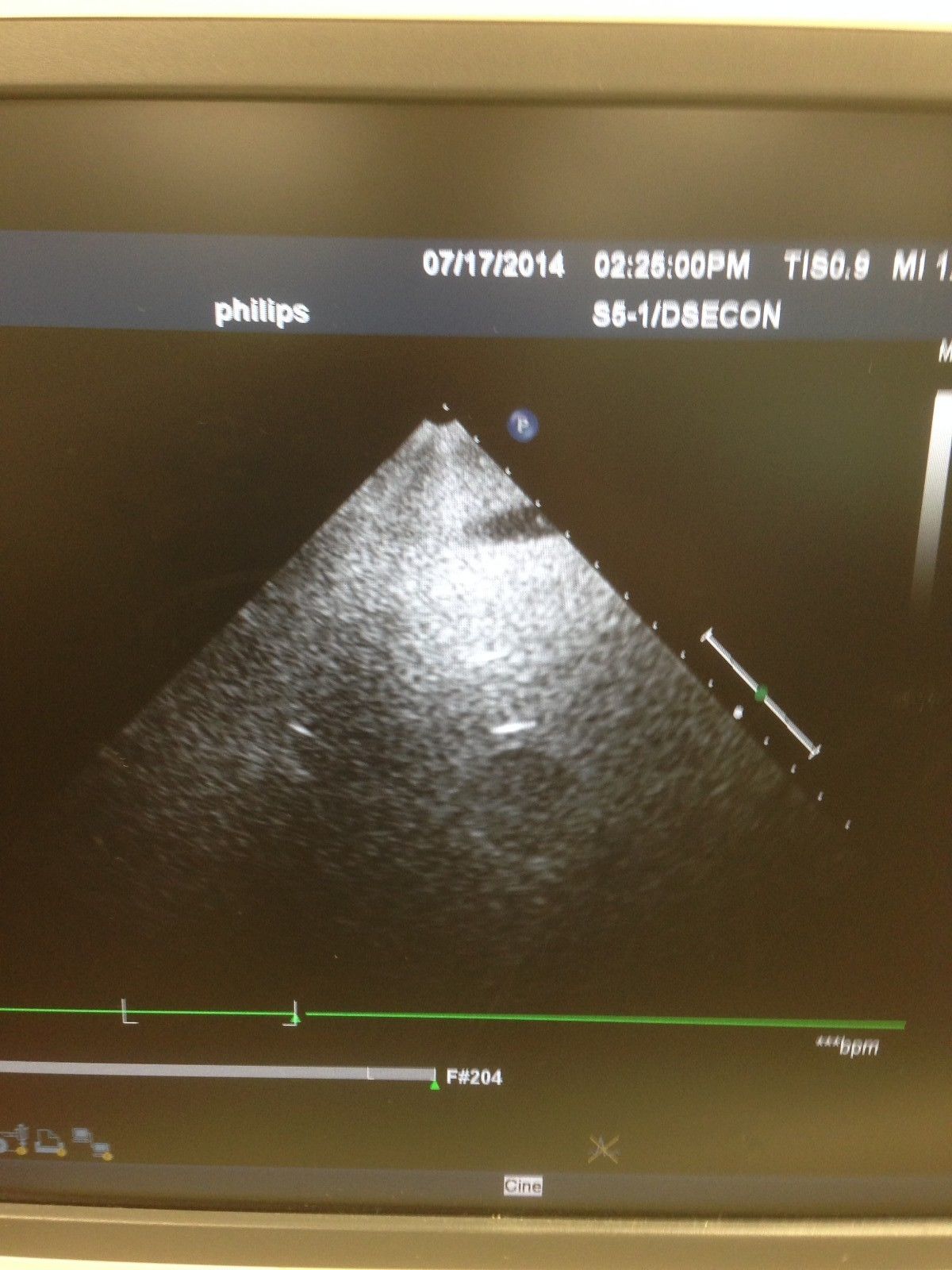 a computer screen with a medical picture