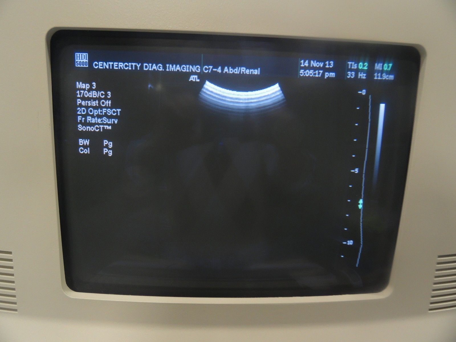 ATL C7-4 40R Curved Array Convex Ultrasound Probe for ATL HDI Series (5966 ) DIAGNOSTIC ULTRASOUND MACHINES FOR SALE