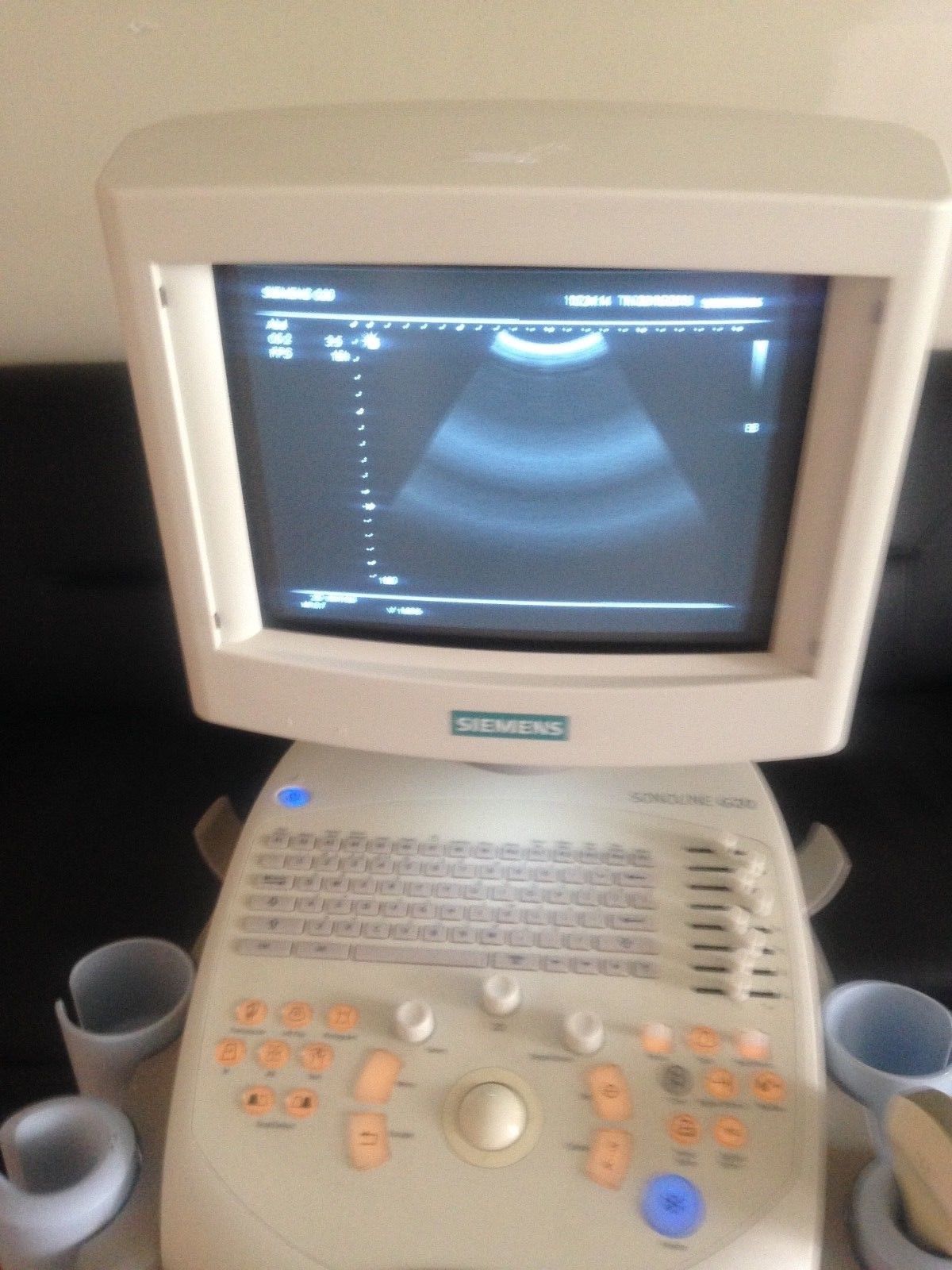 Siemens Sonoline G20 Ultrasound C5-2 Probe & Printer OB-GYN, Urology DIAGNOSTIC ULTRASOUND MACHINES FOR SALE