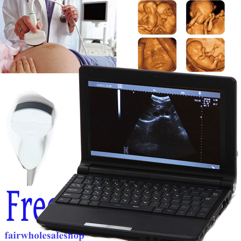New Digital Portable Notebook Laptop Ultrasound Scanner+convex Sensor probe+3D 190891814036 DIAGNOSTIC ULTRASOUND MACHINES FOR SALE