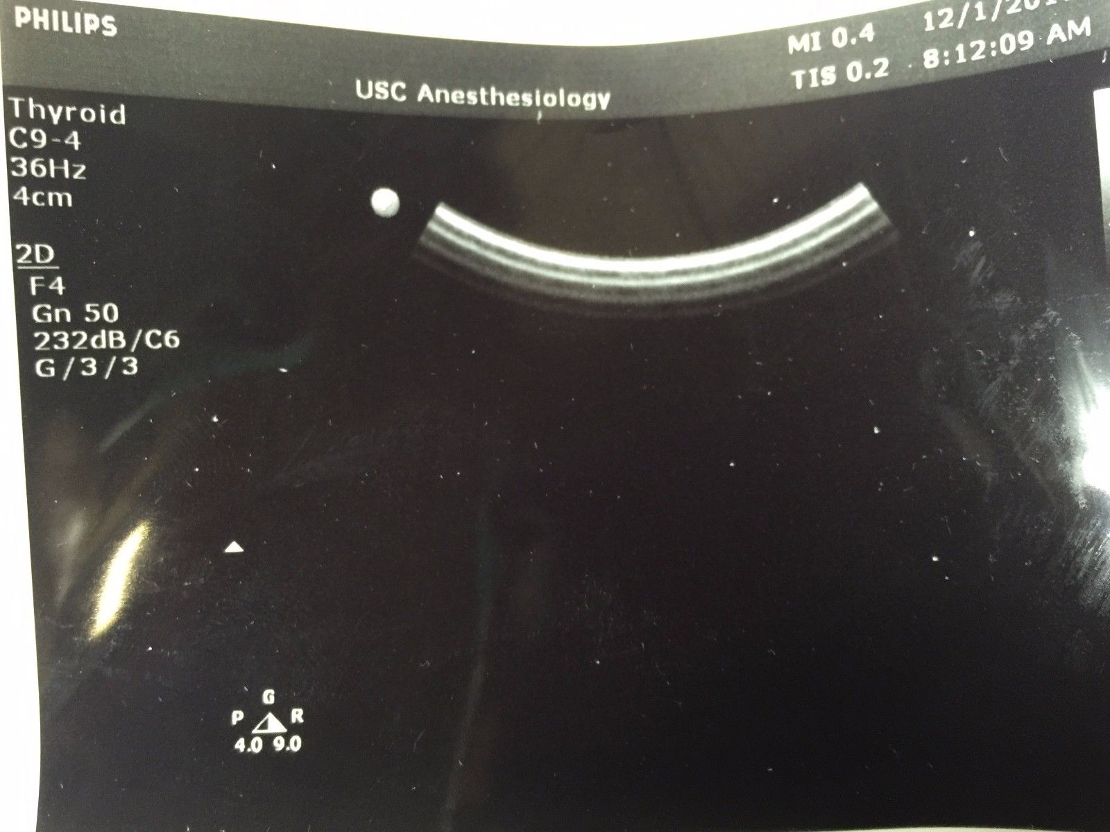 Philips C9-4 Convex Ultrasound Transducer for Philips iU22 Systems DIAGNOSTIC ULTRASOUND MACHINES FOR SALE