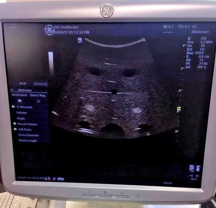 GE Logiq 7 Ultrasound Machine. OB/GYN Radiology Probes available 3.5C, E8C, 9L DIAGNOSTIC ULTRASOUND MACHINES FOR SALE