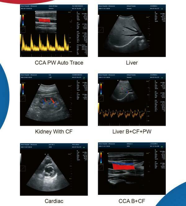 Laptop Color Doppler Ultrasound Scanner Power Doppler Diagnostic Machine System DIAGNOSTIC ULTRASOUND MACHINES FOR SALE