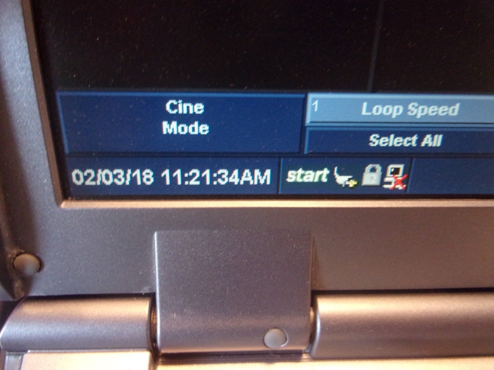 GE LOGIQ E ULTRASOUND With 12L-RS Probe And DOCKING CART DIAGNOSTIC ULTRASOUND MACHINES FOR SALE