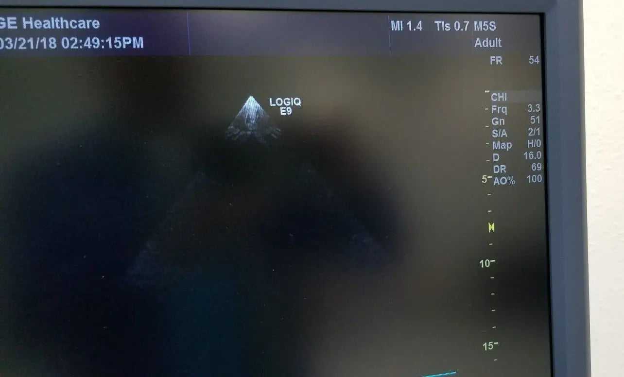 GE M5S-D Ultrasound Probe / Transducer Demo Condition DIAGNOSTIC ULTRASOUND MACHINES FOR SALE