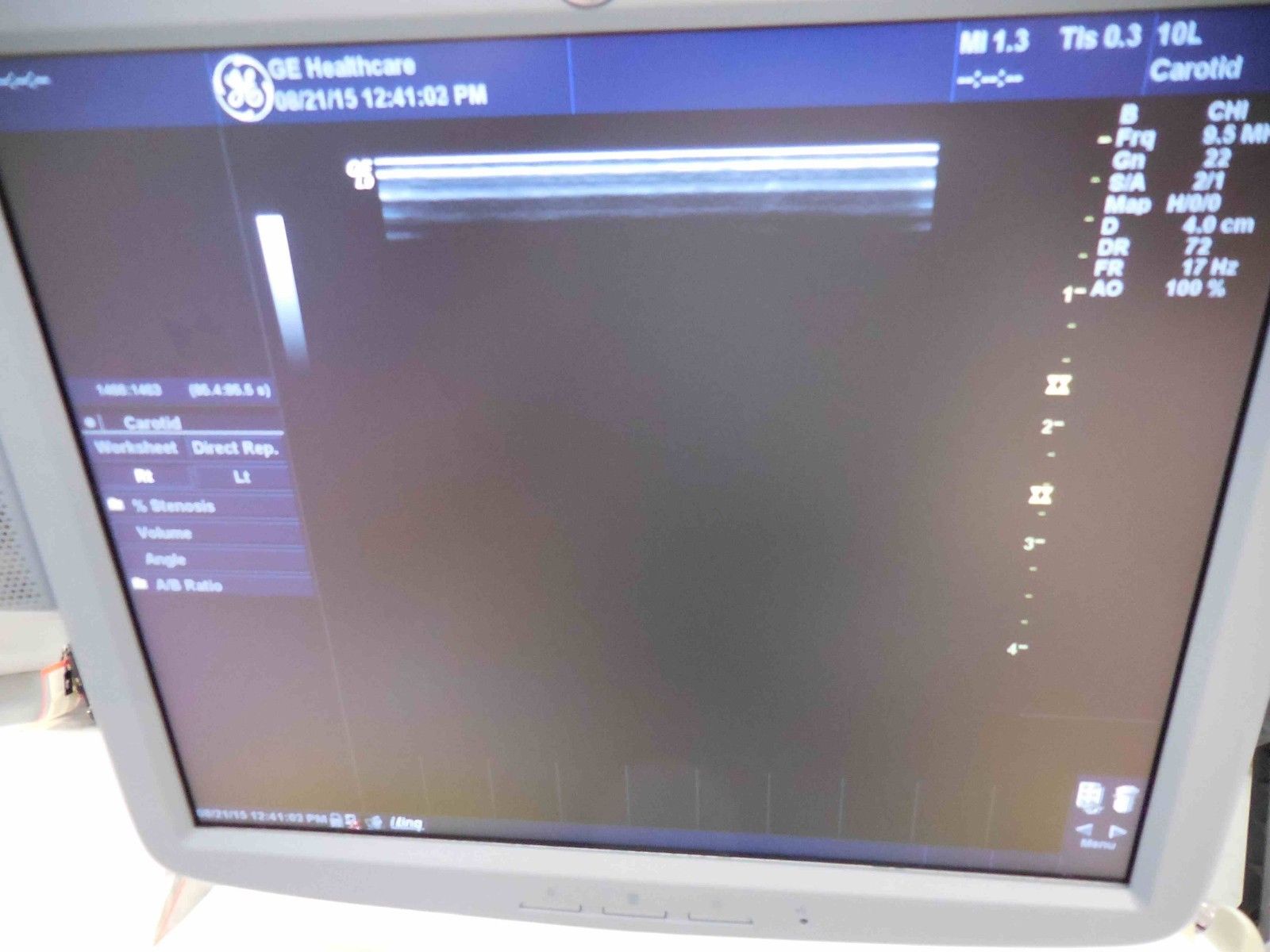 GE Logiq 9 LCD Ultrasound System DIAGNOSTIC ULTRASOUND MACHINES FOR SALE