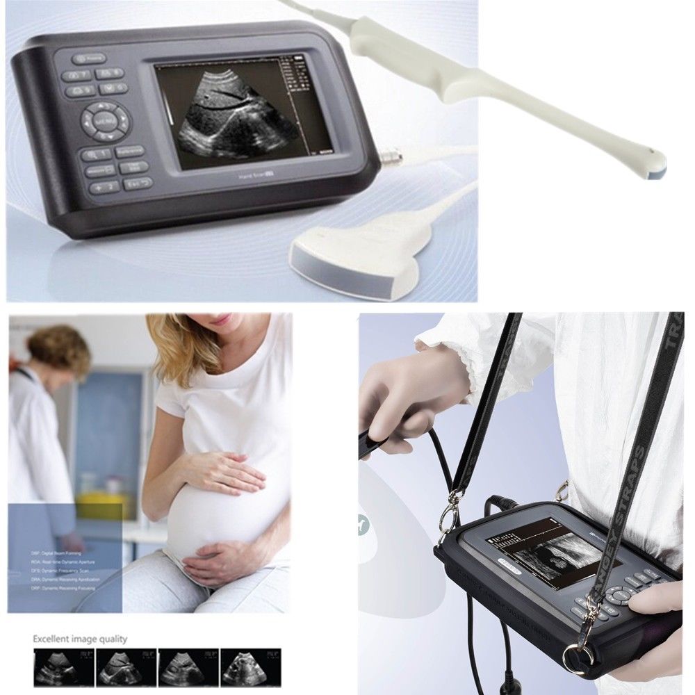 Digital laptop Machine HandScan Ultrasound scanner Convex + Transvaginal Probe 190891758668 DIAGNOSTIC ULTRASOUND MACHINES FOR SALE