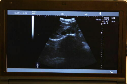 Pro Digital Laptop Ultrasound Machine Linear Array Probe + Transvaginal Probe DIAGNOSTIC ULTRASOUND MACHINES FOR SALE