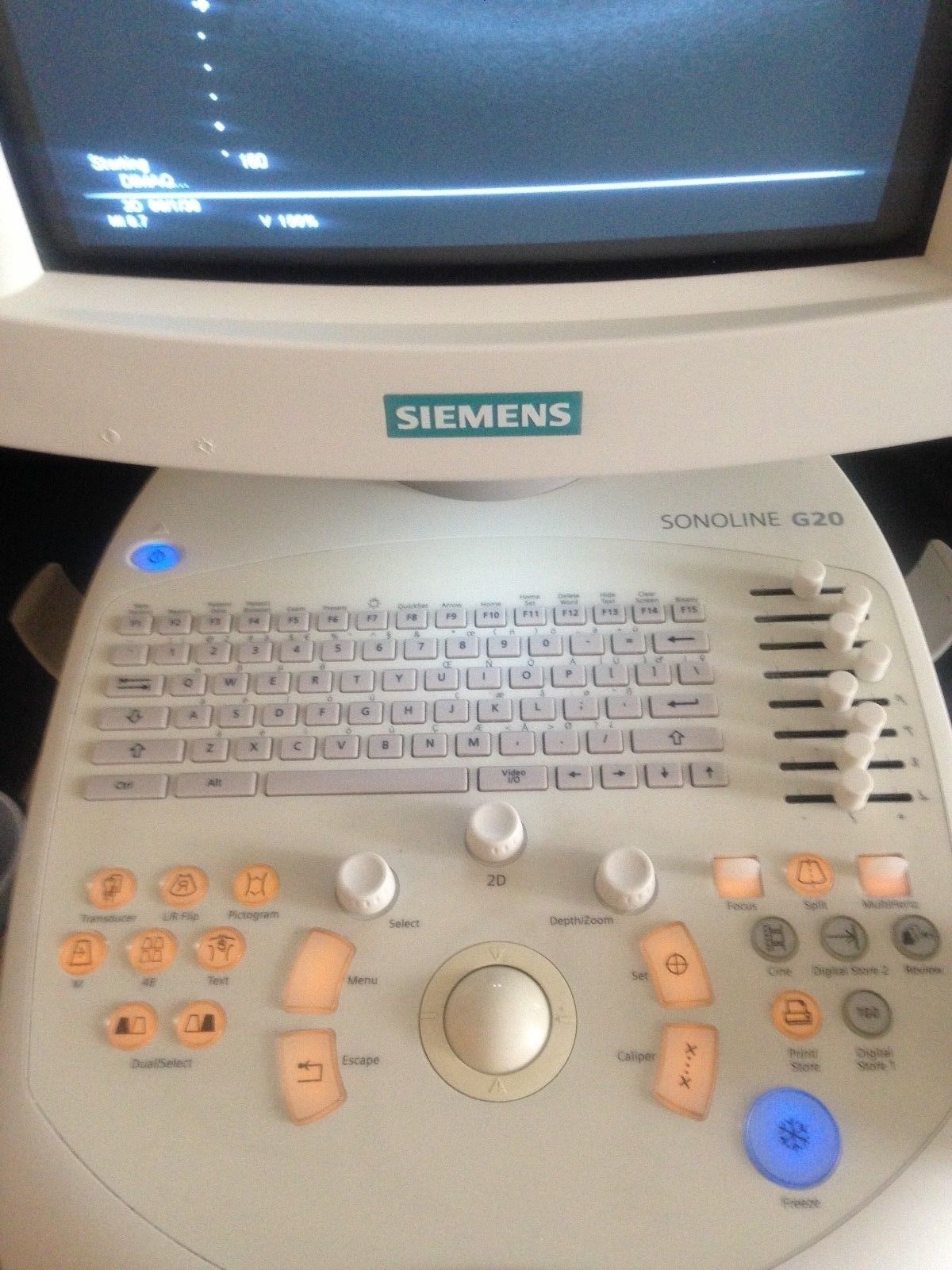 Siemens Sonoline G20 Ultrasound C5-2 Probe & Printer OB-GYN, Urology DIAGNOSTIC ULTRASOUND MACHINES FOR SALE