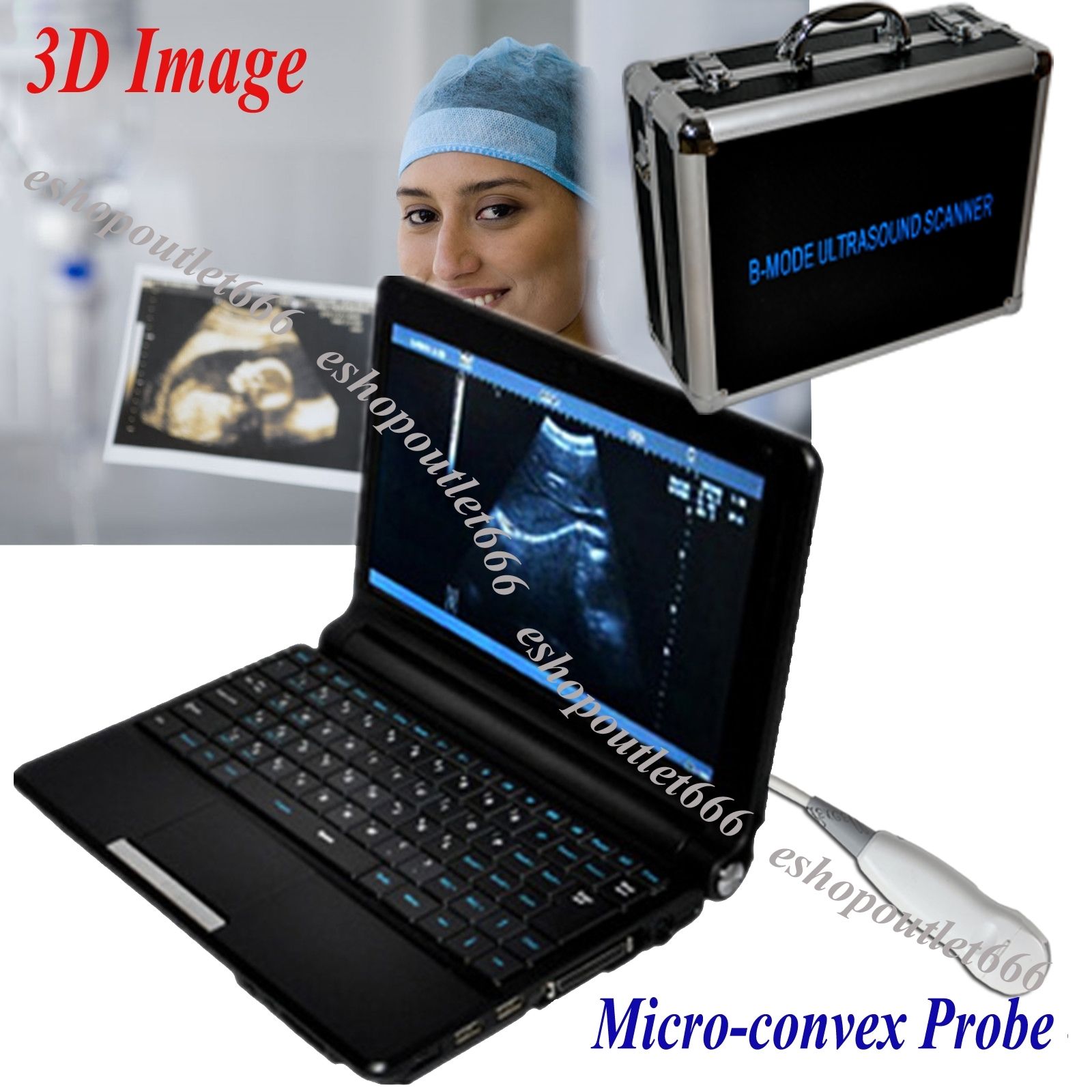 Full Digital Laptop PC Ultrasound Scanner with Mini Micro-convex Probe Carejoy 190891809407 DIAGNOSTIC ULTRASOUND MACHINES FOR SALE