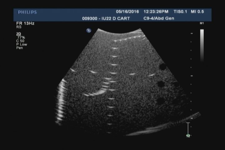 monitor screen black and white