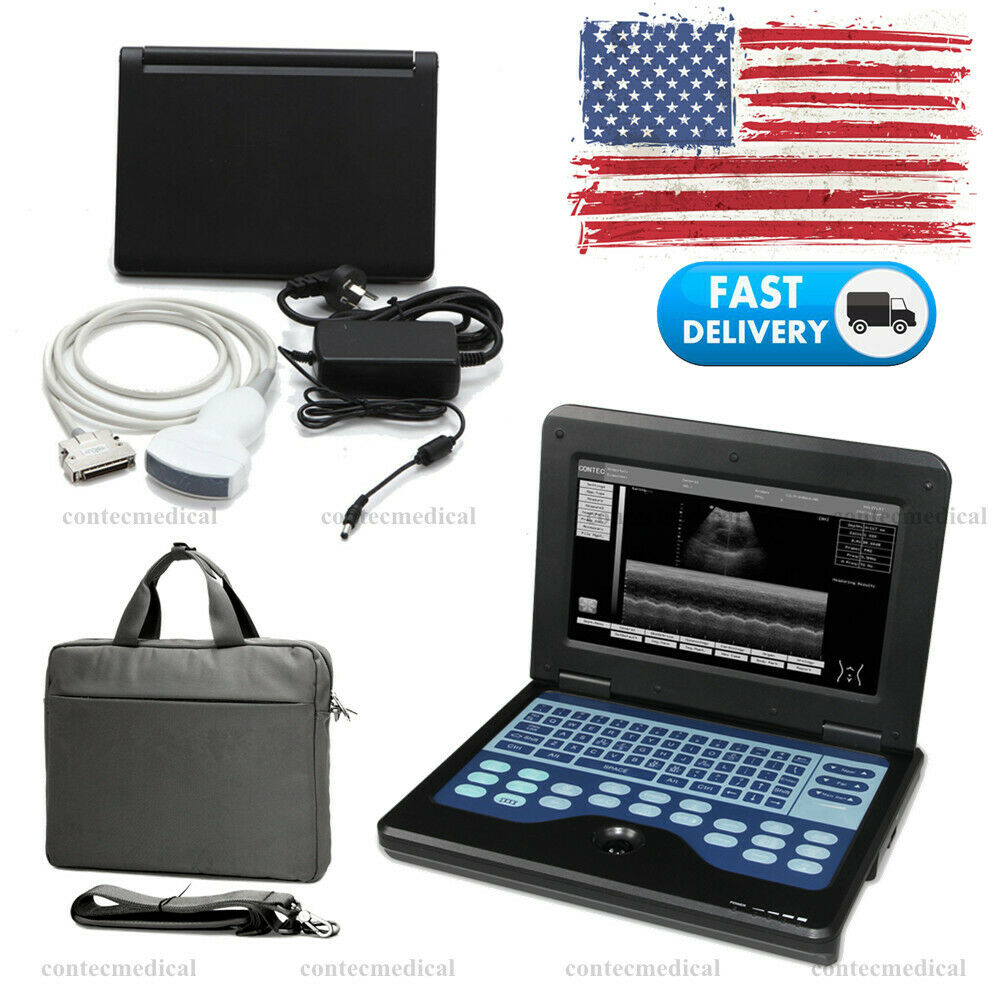 USA Portable Ultrasound Scanner Diagnostic Convex Probe escáner de ultrasonido 6945040100362 DIAGNOSTIC ULTRASOUND MACHINES FOR SALE