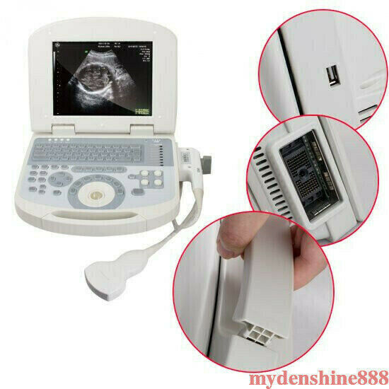 Portable Full 3D Digital Laptop Ultrasound Scanner System Machine + Convex Probe DIAGNOSTIC ULTRASOUND MACHINES FOR SALE