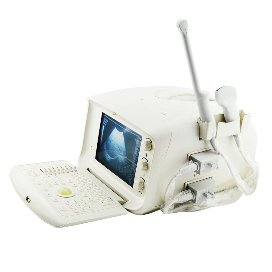 Digital Ultrasound Scanner/Machine 3.5Mhz Convex Transducer/Probe 3D A+ DIAGNOSTIC ULTRASOUND MACHINES FOR SALE