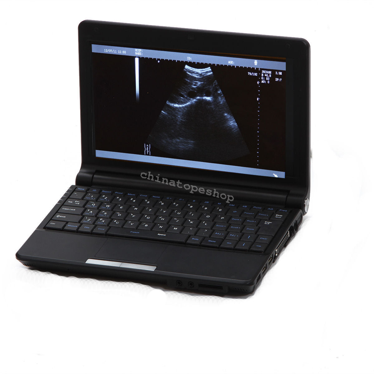 Digital Laptop Notebook ultrasound scanner machine Convex Linear 2 probes 3D 190891559289 DIAGNOSTIC ULTRASOUND MACHINES FOR SALE