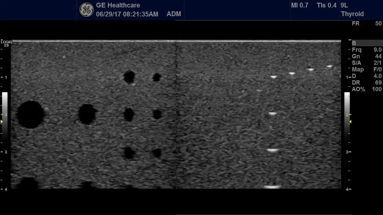 GE Logiq E9 with XDclear Ultrasound System DIAGNOSTIC ULTRASOUND MACHINES FOR SALE