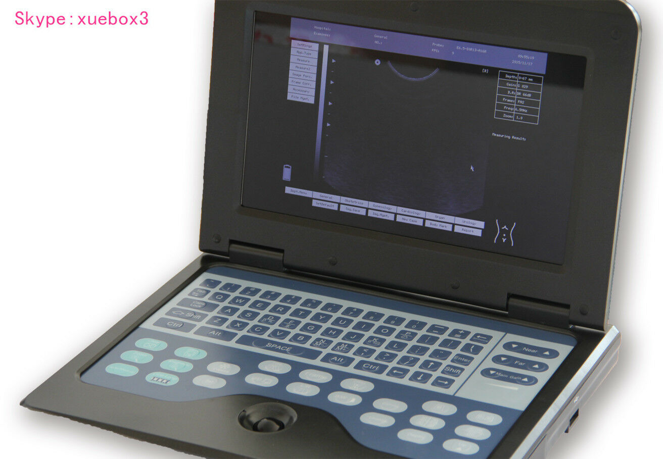 US-Digital-Portable-Ultrasound-Scanner-Machine+Cardiac+Convex Two probes Sale. DIAGNOSTIC ULTRASOUND MACHINES FOR SALE