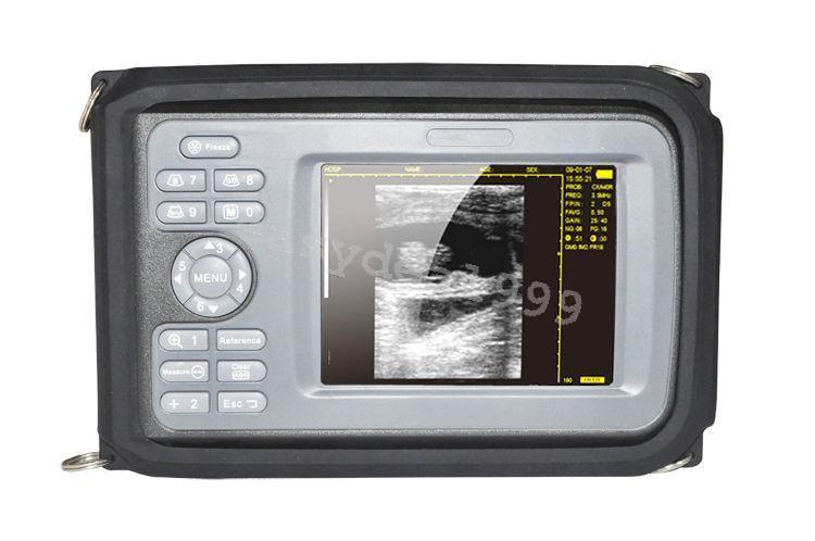 Portable Handheld Ultrasound Scanner + Transvaginal Probe + Rechargeable Battery DIAGNOSTIC ULTRASOUND MACHINES FOR SALE