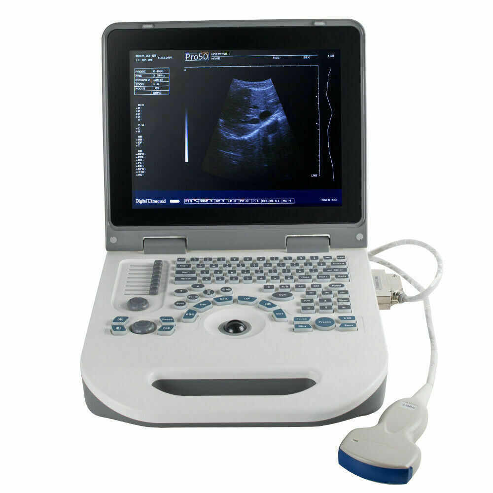 Portable Digital Ultrasound Scanner Ultrasonic MachineDisgnos Convex Probe 3D CE DIAGNOSTIC ULTRASOUND MACHINES FOR SALE