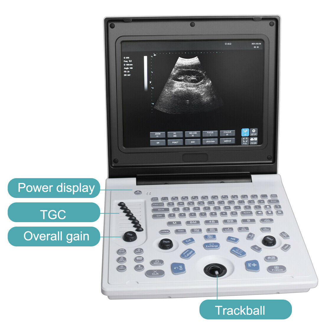 Portable 12''LED Screen Full Digital Ultrasound Scanner + 3.5MHz Convex Probe DIAGNOSTIC ULTRASOUND MACHINES FOR SALE