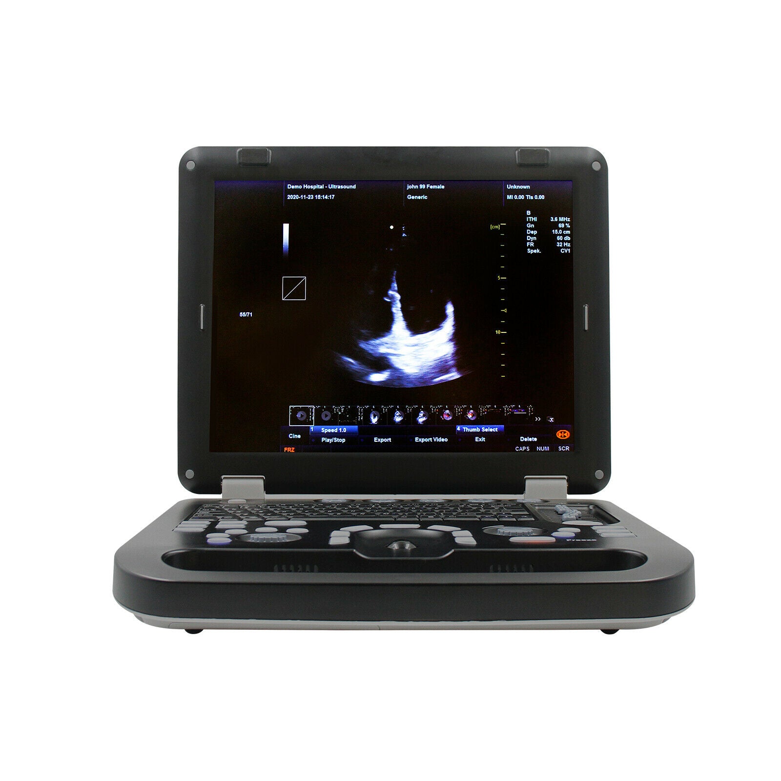 Portable Ultrasound Scanner Color Doppler Machine+ Convex Probe, PW CW,USB+Video DIAGNOSTIC ULTRASOUND MACHINES FOR SALE