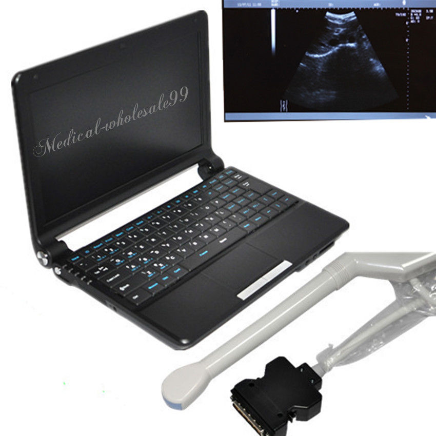 Laptop Ultrasound Scanner/Machine Convex & Linear Probes Ultrasonic Scanner Sale 190891210463 DIAGNOSTIC ULTRASOUND MACHINES FOR SALE