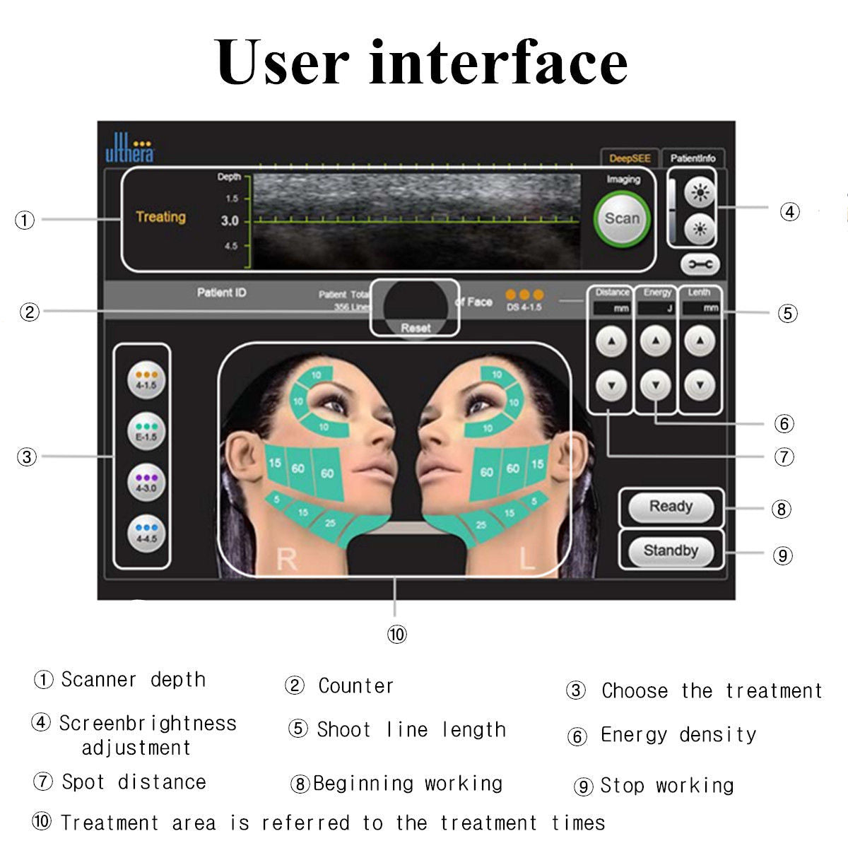High Intensity Focused Ultrasound HIFU Care Facial Skin Spa Anti Aging Machine 6930402318325 DIAGNOSTIC ULTRASOUND MACHINES FOR SALE