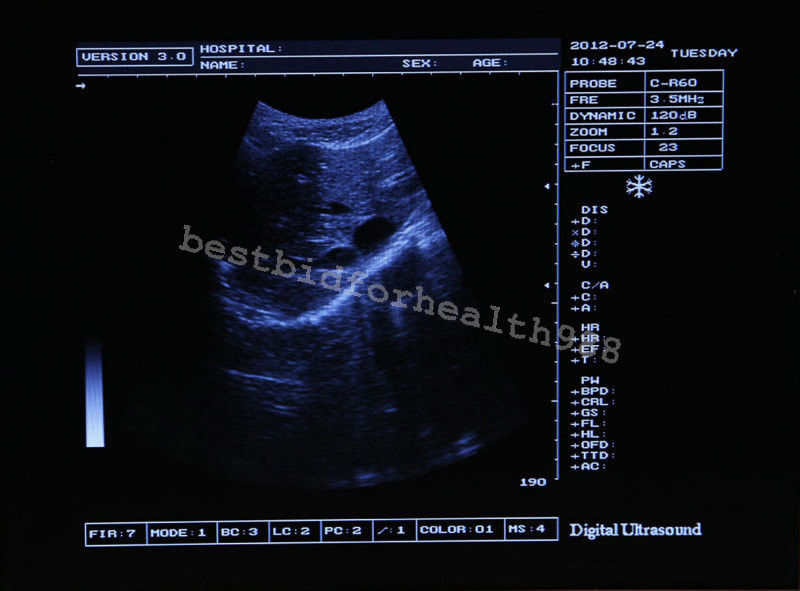 Digital LCD Ultrasound Scanner Handheld Scan Machine with Micro-convex Probe 3D DIAGNOSTIC ULTRASOUND MACHINES FOR SALE