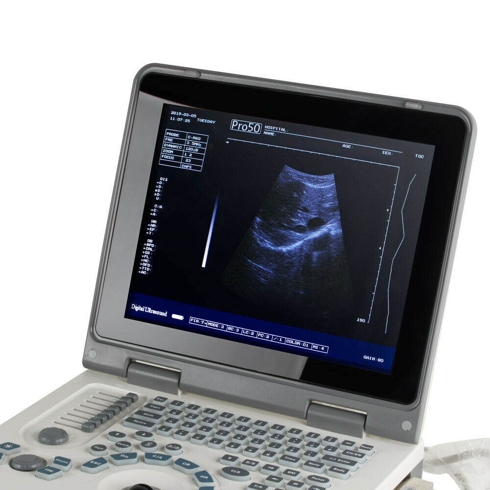 Portable Laptop Machine Digital Ultrasound scanner 3.5MHz Convex probe 3D Staion DIAGNOSTIC ULTRASOUND MACHINES FOR SALE