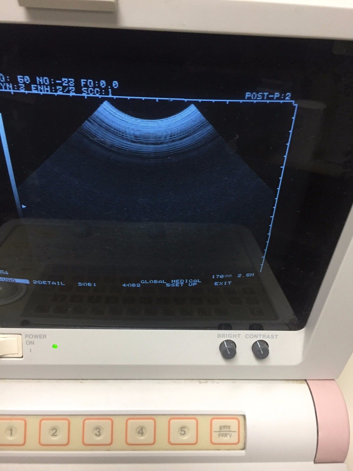 Hitachi EUB-405 Plus Ultrasound / 2 probes / 2 transducer port / printer DIAGNOSTIC ULTRASOUND MACHINES FOR SALE