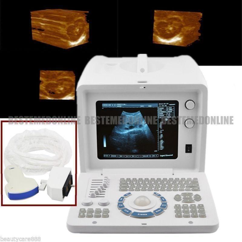 Portable Digital Ultrasound machine Scanner+3.5Mhz convex Probe+*3Dworkstation** 190891888099 DIAGNOSTIC ULTRASOUND MACHINES FOR SALE