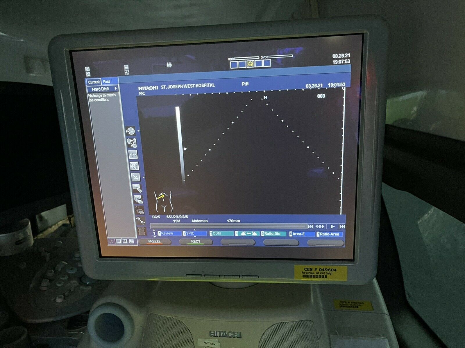 Hitachi Hi Vision 900 Ultrasound Machine DIAGNOSTIC ULTRASOUND MACHINES FOR SALE