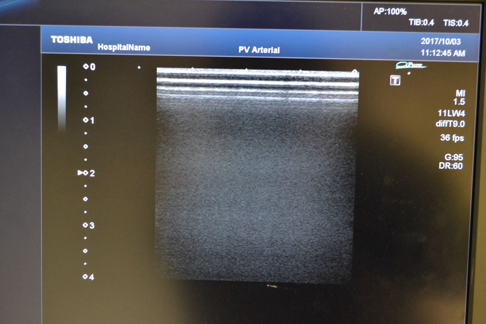 Toshiba Artida PLT-704SBT 11-4.8MHz Linear Ultrasound Transducer Probe  J1626 DIAGNOSTIC ULTRASOUND MACHINES FOR SALE