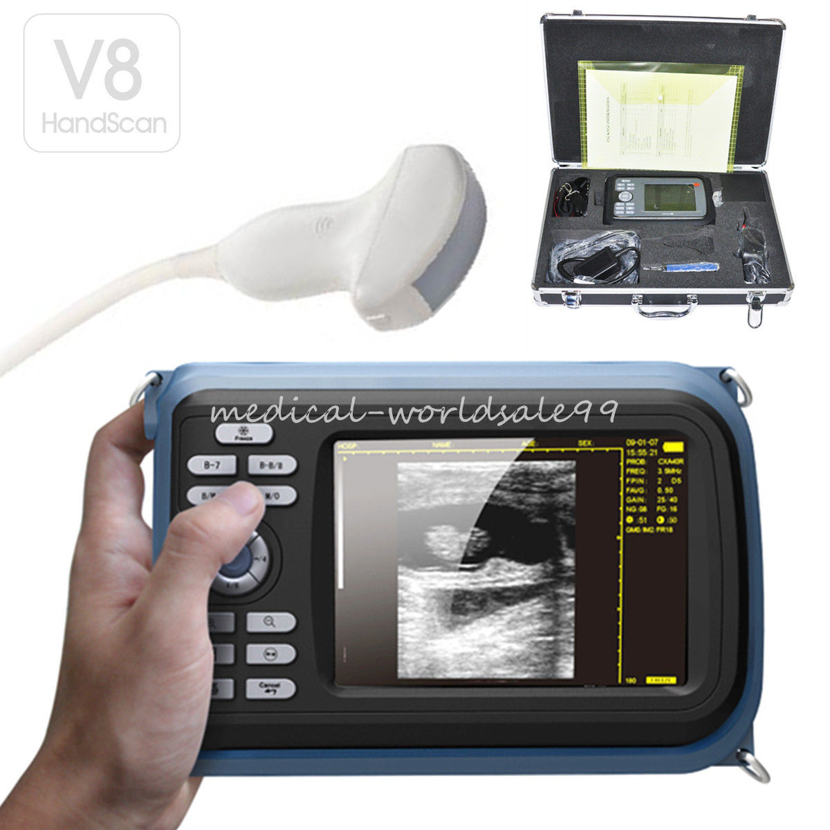 Digital Handheld Ultrasound Scanner Ultrasound Machine Micro-Convex Probe A+ DIAGNOSTIC ULTRASOUND MACHINES FOR SALE