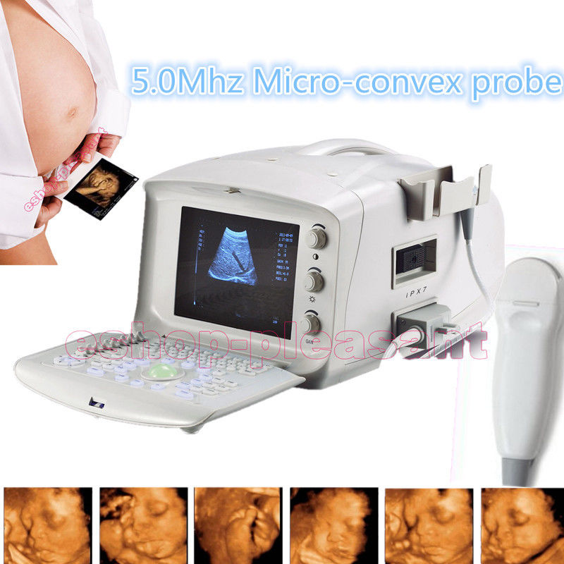 Free 3D !!! Digital Ultrasound Scanner Micro 3.5Mhz Convex Cardiac Probe+ DHL 190891812032 DIAGNOSTIC ULTRASOUND MACHINES FOR SALE