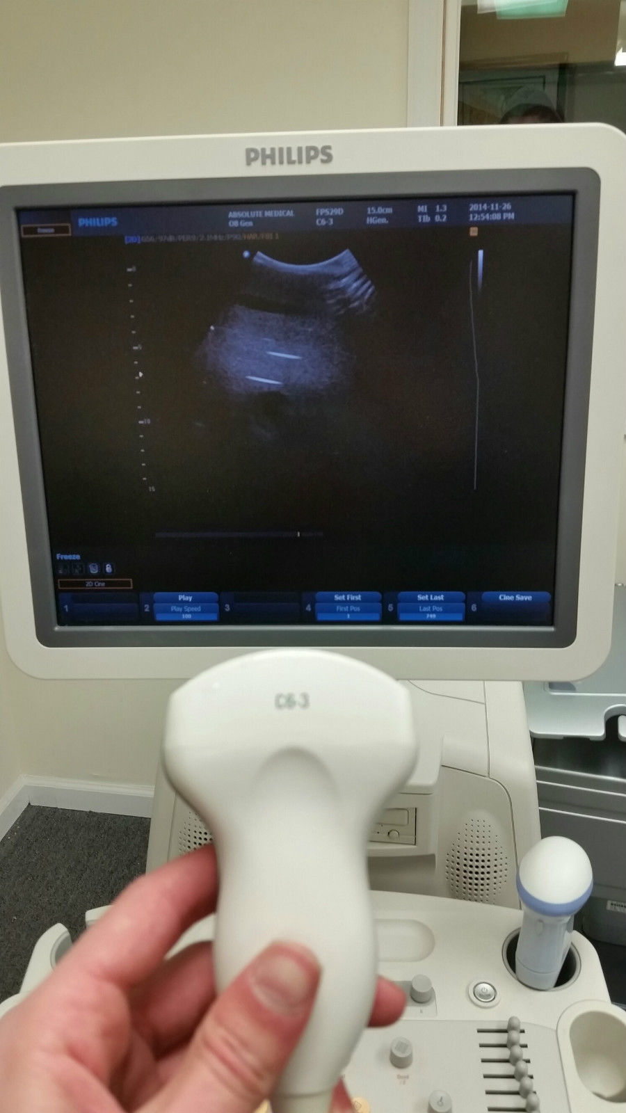 a person holding a probe in front of a monitor