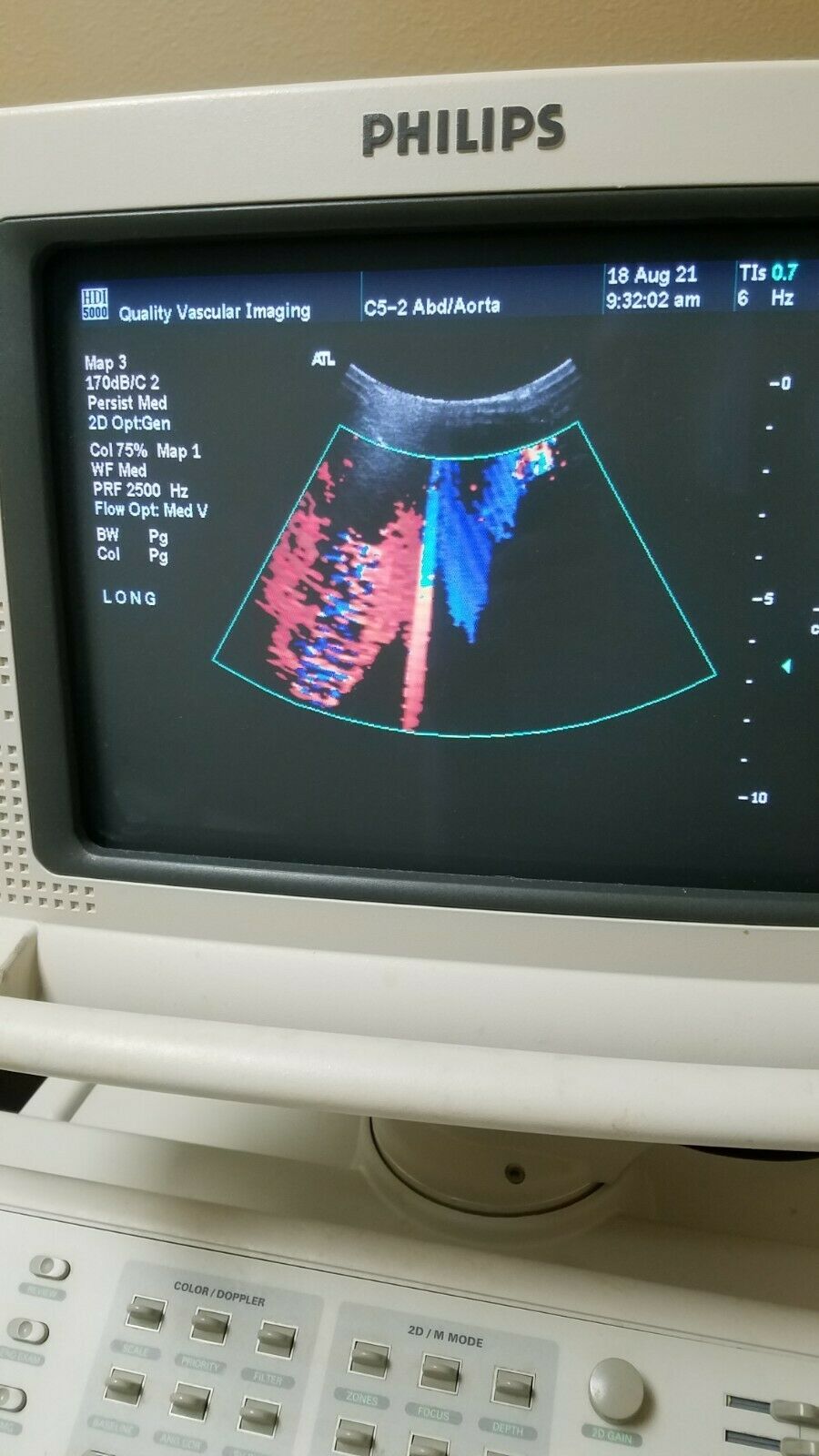 Phillips HDI 5000 Ultrasound Instrument DIAGNOSTIC ULTRASOUND MACHINES FOR SALE