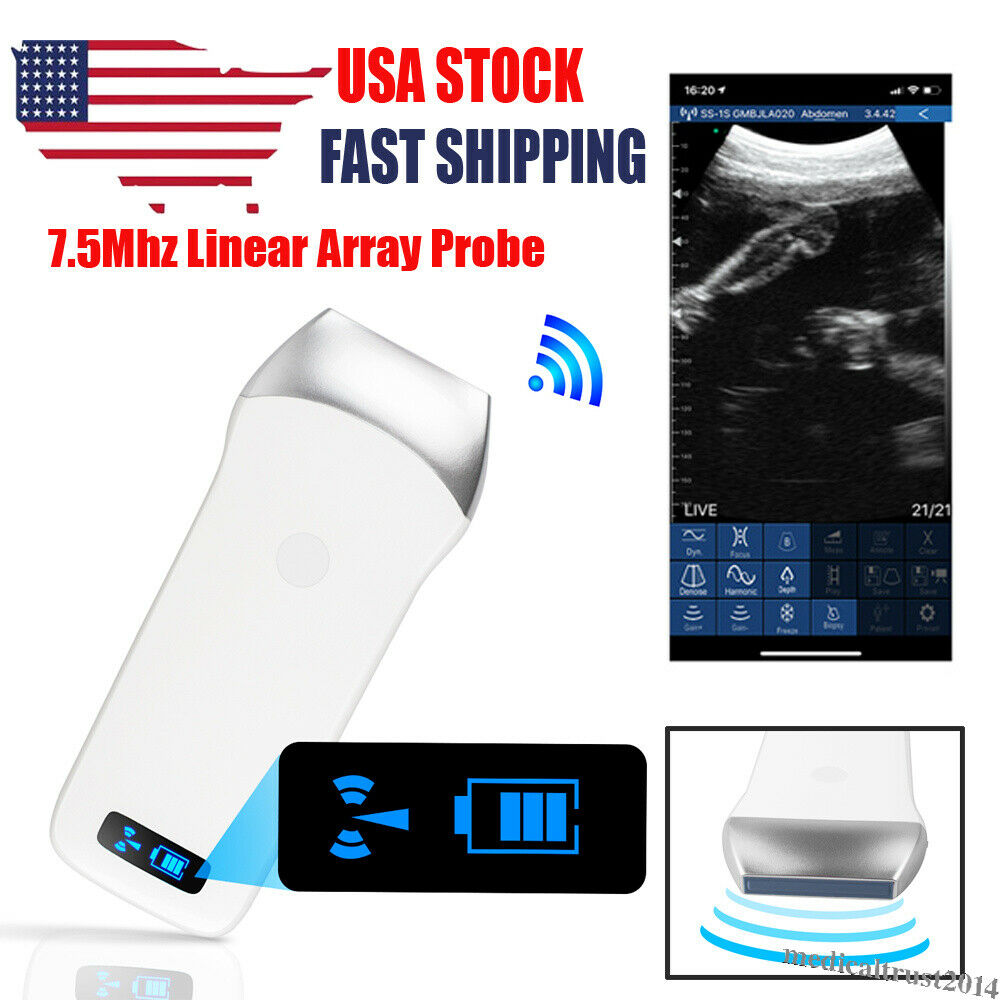Portable Handheld WIFI Wireless Ultrasound Scanner Machine Linear Probe 7.5Mhz DIAGNOSTIC ULTRASOUND MACHINES FOR SALE