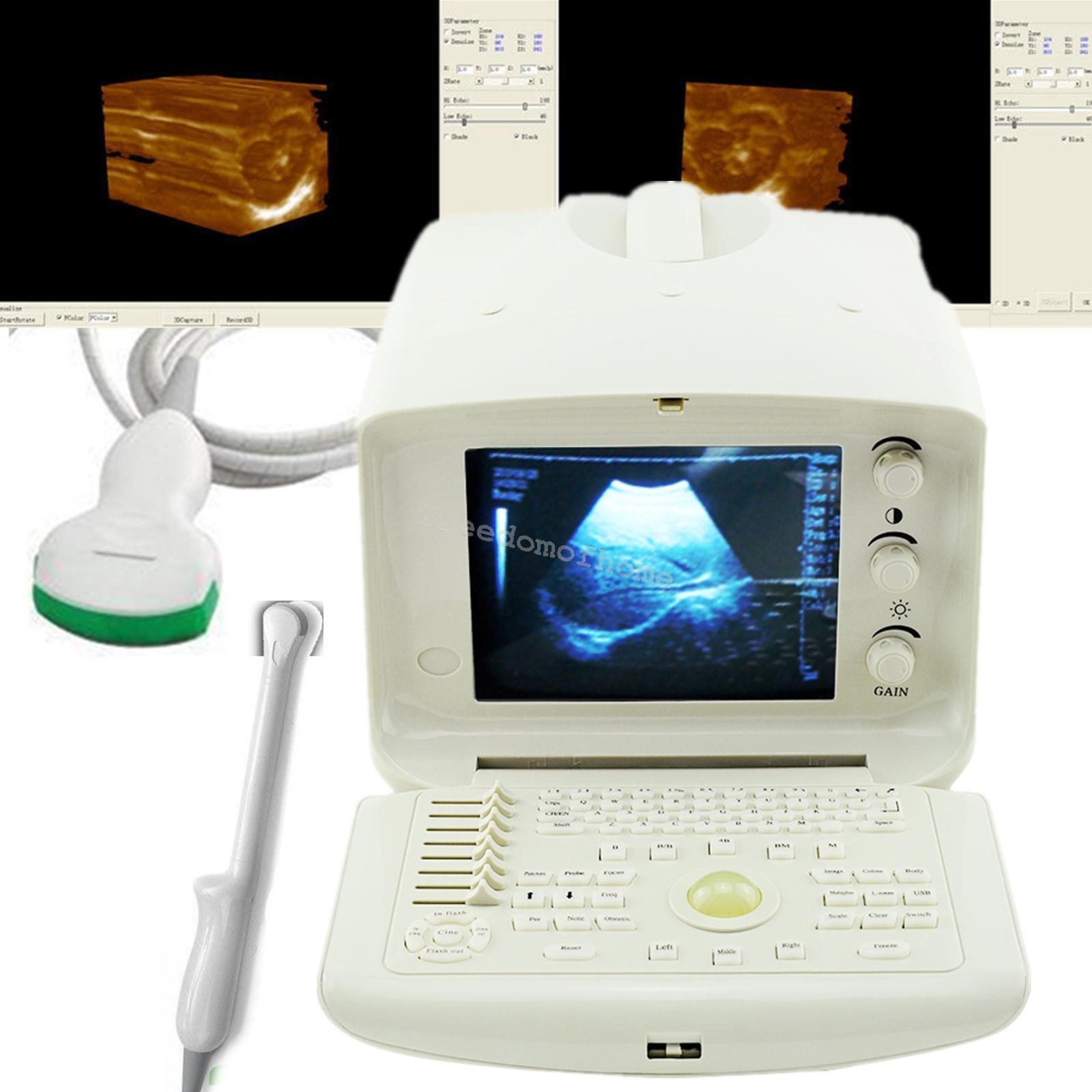 Full Digital Portable Ultrasound Scanner machine +Convex + Vignial 2 Probes+3D DIAGNOSTIC ULTRASOUND MACHINES FOR SALE