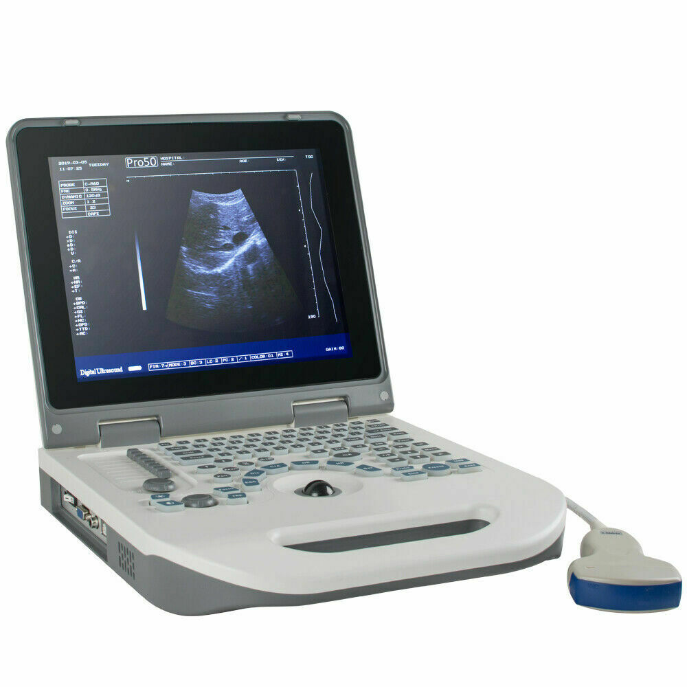 Portable Digital Ultrasound Scanner Ultrasonic MachineDisgnos Convex Probe 3D CE DIAGNOSTIC ULTRASOUND MACHINES FOR SALE